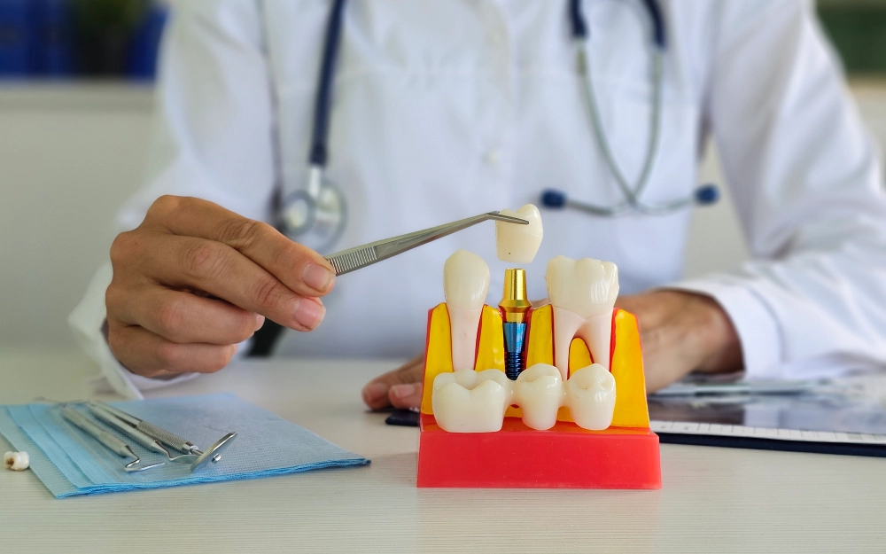 Dentist demonstrating dental implant with model.